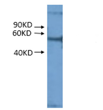 western blot using anti-RPS2 (mitochondrial) antibdodies